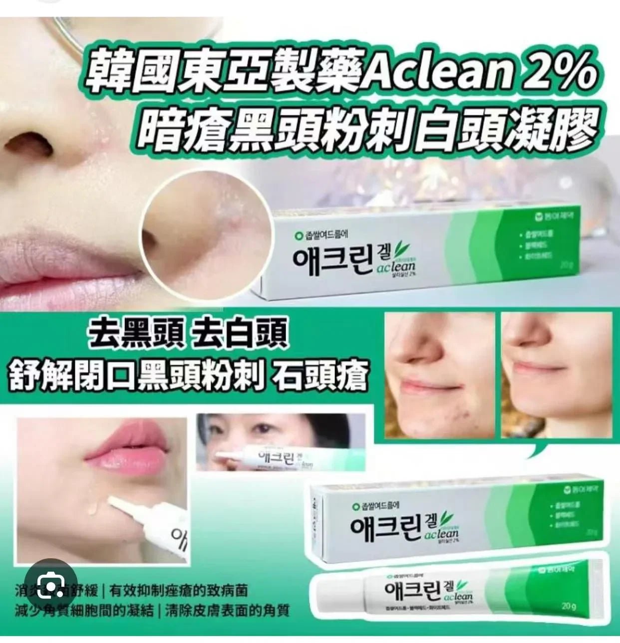 藥房 東亞製藥 Aclean 2%水楊酸去黑頭粉刺酒米凝膠啫喱 - HLY &amp; CHOCCICO