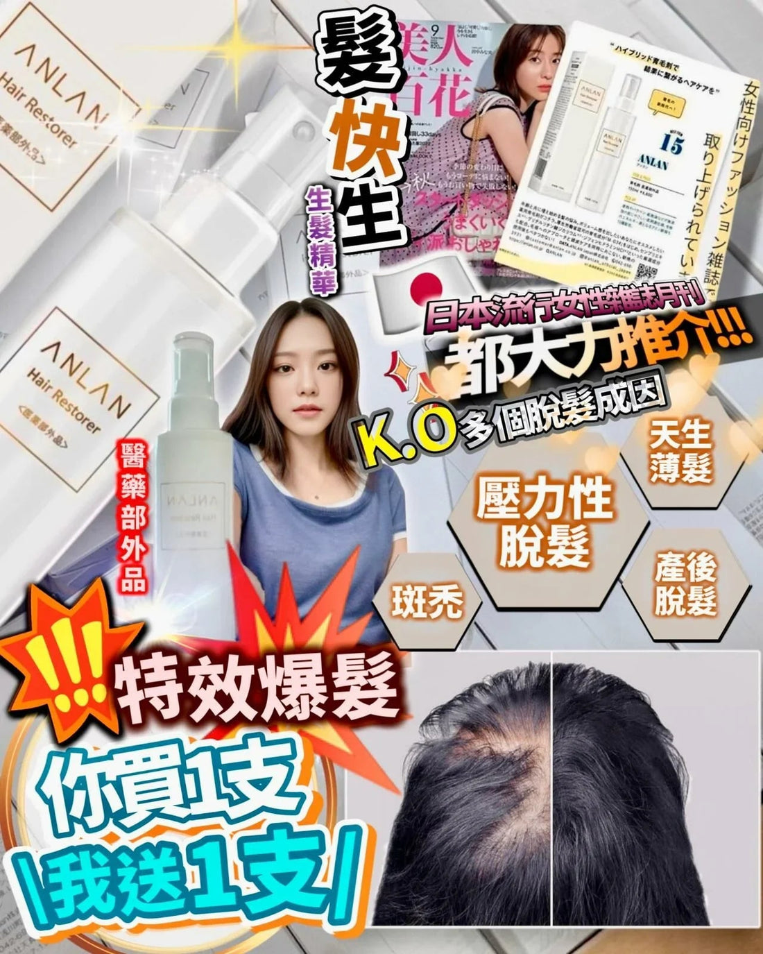 Anlan 髮快生 育髮精華 150ml‼️買1送1‼️ - HLY &amp; CHOCCICO