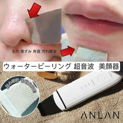 🇯🇵日本ANLAN 超聲波剷皮機 - HLY &amp; CHOCCICO