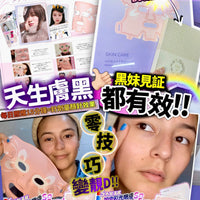 Anlan面罩+Botox面膜 - HLY & CHOCCICO