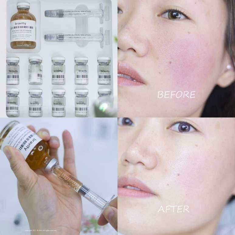 韓國Bravity DERMA STEM CELL 35 PROGRAM 羊膜水幹細胞35修護套盒〔美容院裝〕 - HLY &amp; CHOCCICO