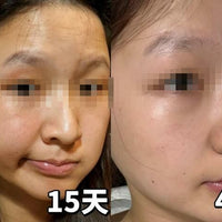 美國🇺🇸-微晶磨皮拋光劑 + 面膜(雙效維生素 C 面膜)80g - HLY & CHOCCICO