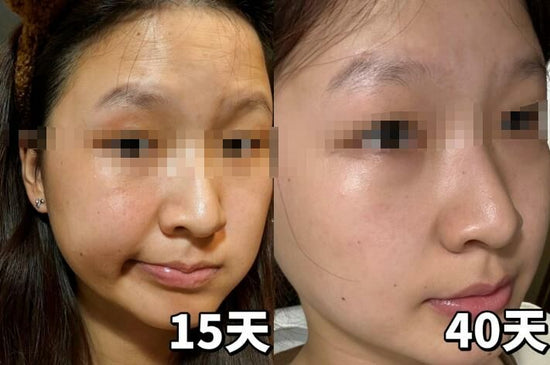 USA 🇺🇸-Microdermabrasion Polisher + Mask (Dual Effect Vitamin C Mask) 80g 