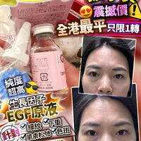 CellBic 日本EGF協會認定 高濃度EGF美容液精華液 20ml - HLY & CHOCCICO