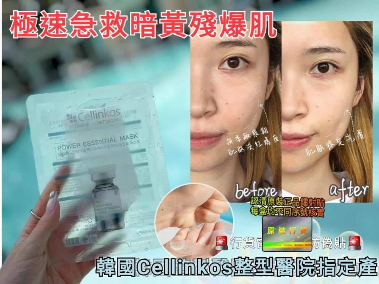 Cellinko光子嫩膚面膜一包10片 - HLY &amp; CHOCCICO