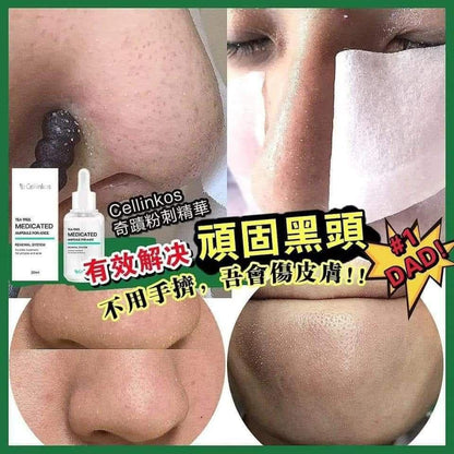 📢韓國爆單皇！Cellinkos 粉刺精華 - HLY &amp; CHOCCICO