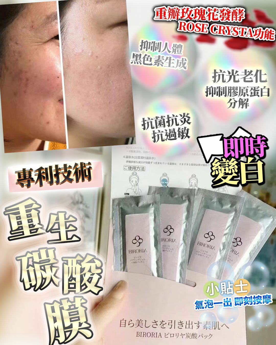 CO2重生碳酸面膜 HLY & CHOCCICO