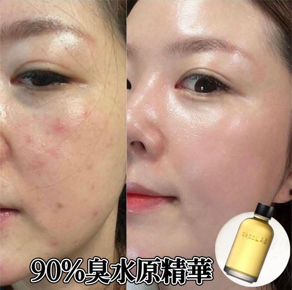 Crop LAB 90%臭水 ✨買一送一 - HLY & CHOCCICO