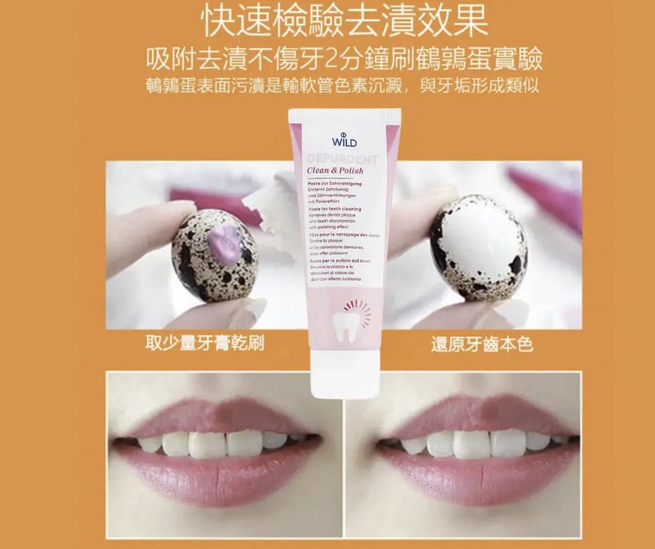 新版⭐瑞士製造🇨🇭Depurdent去漬美白拋光牙膏75 ml⭐ 純植物配方🌱 HLY & CHOCCICO