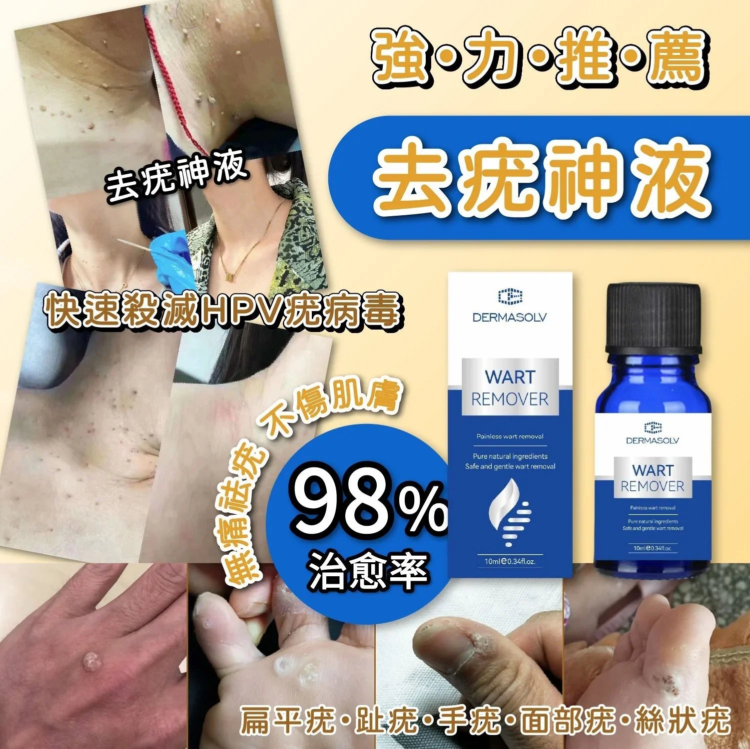 DermaSolv強力去疣神液10ml - HLY &amp; CHOCCICO