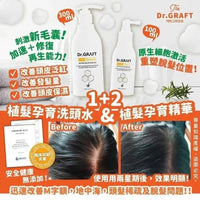 韓國🇰🇷Dr.GRAFT 植髮皇 孕育洗頭水300ml/ 孕育精華100ml HLY & CHOCCICO