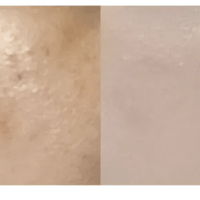 ★ Dr.Melaxin 逆齢專家 TX 超強 去角質美白爽膚水 150ml HLY & CHOCCICO