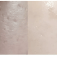 ★ Dr.Melaxin 逆齢專家 TX 超強 去角質美白爽膚水 150ml HLY & CHOCCICO