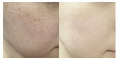 ★ Dr.Melaxin 逆齢專家 TX 超強 去角質美白爽膚水 150ml - HLY &amp; CHOCCICO