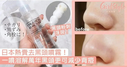 日本🇯🇵 長期銷量冠軍🏆 EARA 水橋保壽堂去黑頭噴霧 Emulsion Remover 200ml - HLY &amp; CHOCCICO