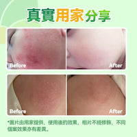 日本Healthive 天然抗敏消紅止癢多用途消炎修護母嬰級皮膚凝膠120ml - HLY & CHOCCICO