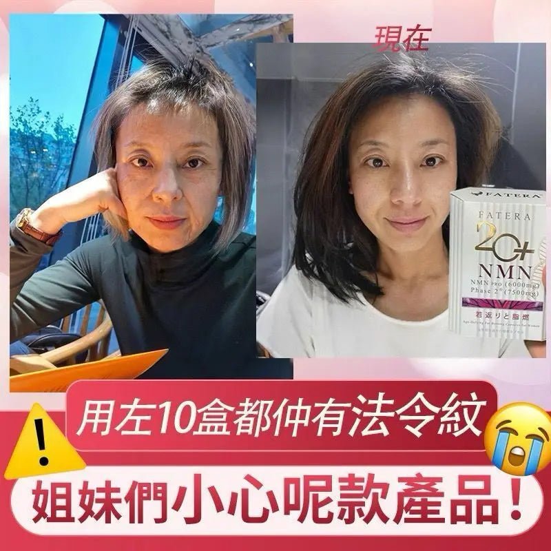 【一口價$248 /盒】Fatera 20+ NMN - HLY & CHOCCICO