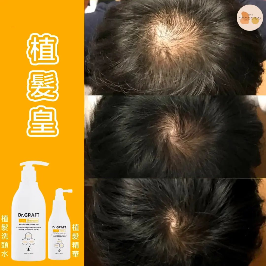 韓國🇰🇷Dr.GRAFT 植髮皇 孕育洗頭水300ml/ 孕育精華100ml HLY &amp; CHOCCICO