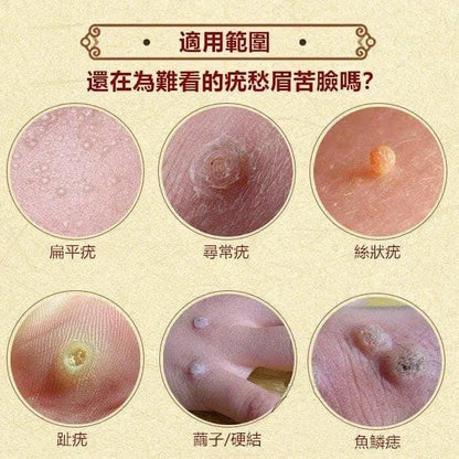 【一口價$75/支】日本製 日本皮膚強力推薦 去疣神膏 10g  |炎症| 疣皮膚病| 傷痕 | 燙傷 |粉刺 - HLY &amp; CHOCCICO
