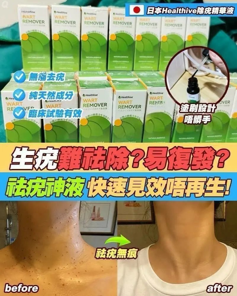 【一口價$170/支】日本🇯🇵 Healthive 除疣精華液 (10ml) HLY &amp; CHOCCICO