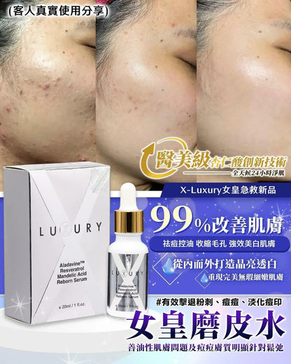 【一口價$298/支】新一代美白皇 Luxury 至臻賦活磨皮水30ml HLY & CHOCCICO