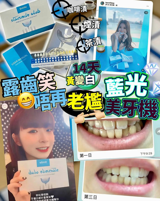 【一口價$328/部】StarSmileClub美國🇺🇸藍光美白牙齒機