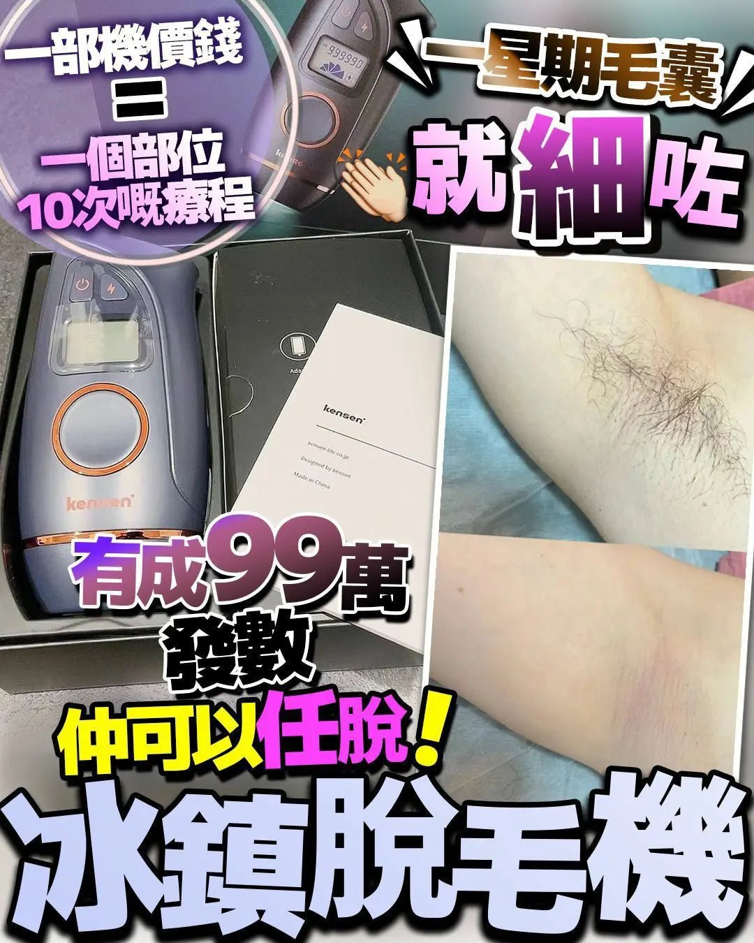 【一口價$499/部】Kensen 冰鎮脫毛機 - HLY & CHOCCICO