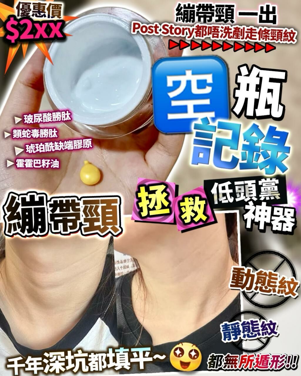 繃帶頸 - HLY &amp; CHOCCICO