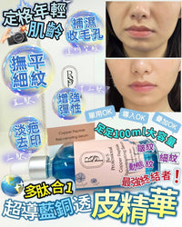 𝑹𝒆 𝑺 𝑷𝒓𝒐超導藍銅透皮精華 - HLY & CHOCCICO