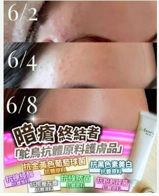 日本 Adsorb 暗瘡終結者 25g - HLY & CHOCCICO