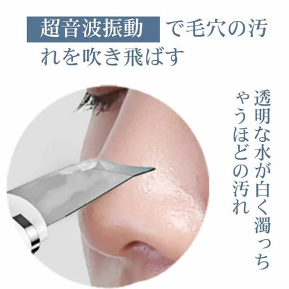 🇯🇵日本ANLAN 超聲波剷皮機 HLY &amp; CHOCCICO