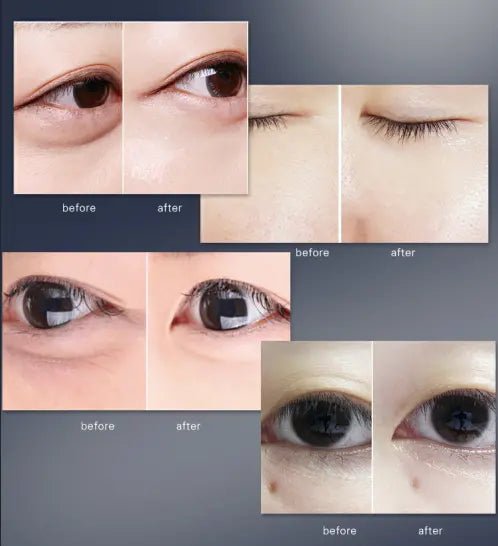 Cellinkos 全新升級版 Magic Eye 逆時針  💥正貨雷射貼💥 HLY & CHOCCICO