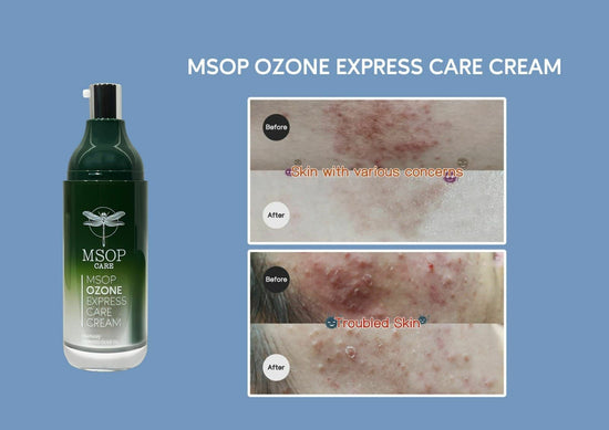 MSOP濕疹修復皇 ✨買一送一