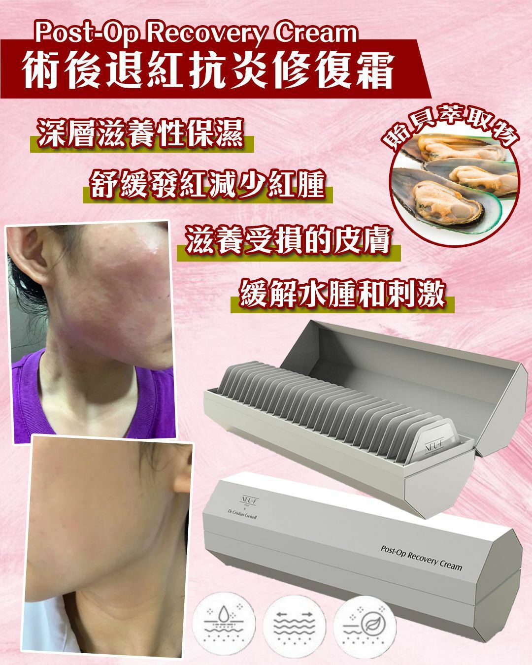 NEU-F Pro x Dr. Cristian Creixell Post-Op Recovery Cream - HLY & CHOCCICO