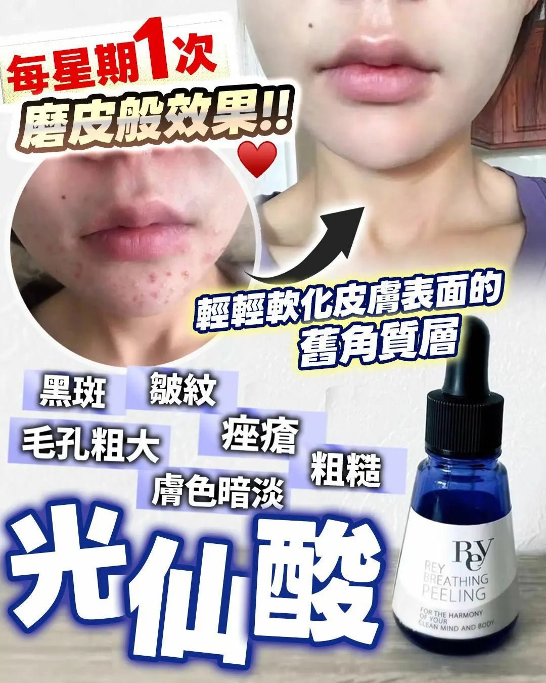 日本美容院✨光仙液peeling 30ml - HLY & CHOCCICO