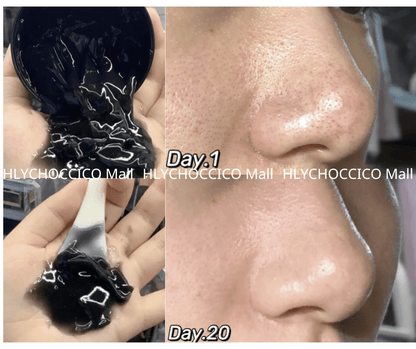 🌟 RNW 黑炭袪黑頭毛孔清潔凍膜 200ml🌟 - HLY &amp; CHOCCICO
