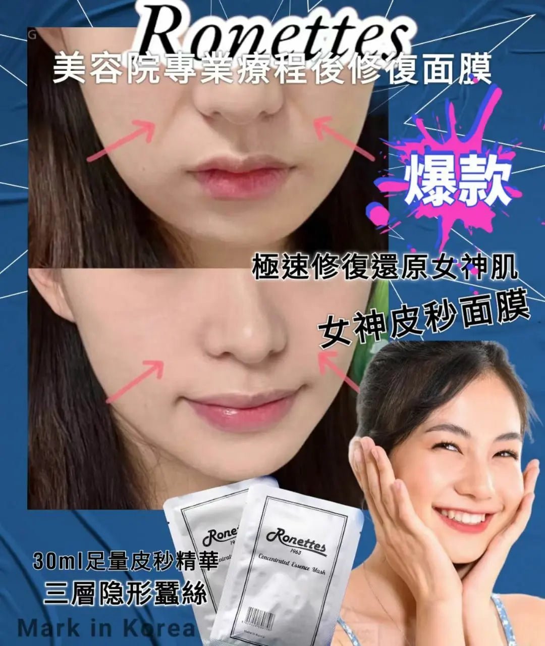 韓國製造Ronettes 時光逆轉皮秒面膜30ml (10片) HLY & CHOCCICO