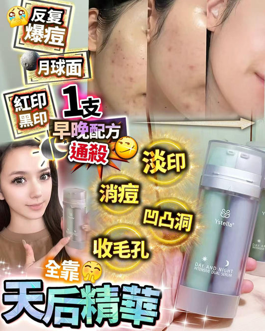 Ystella淡印天后 - HLY & CHOCCICO