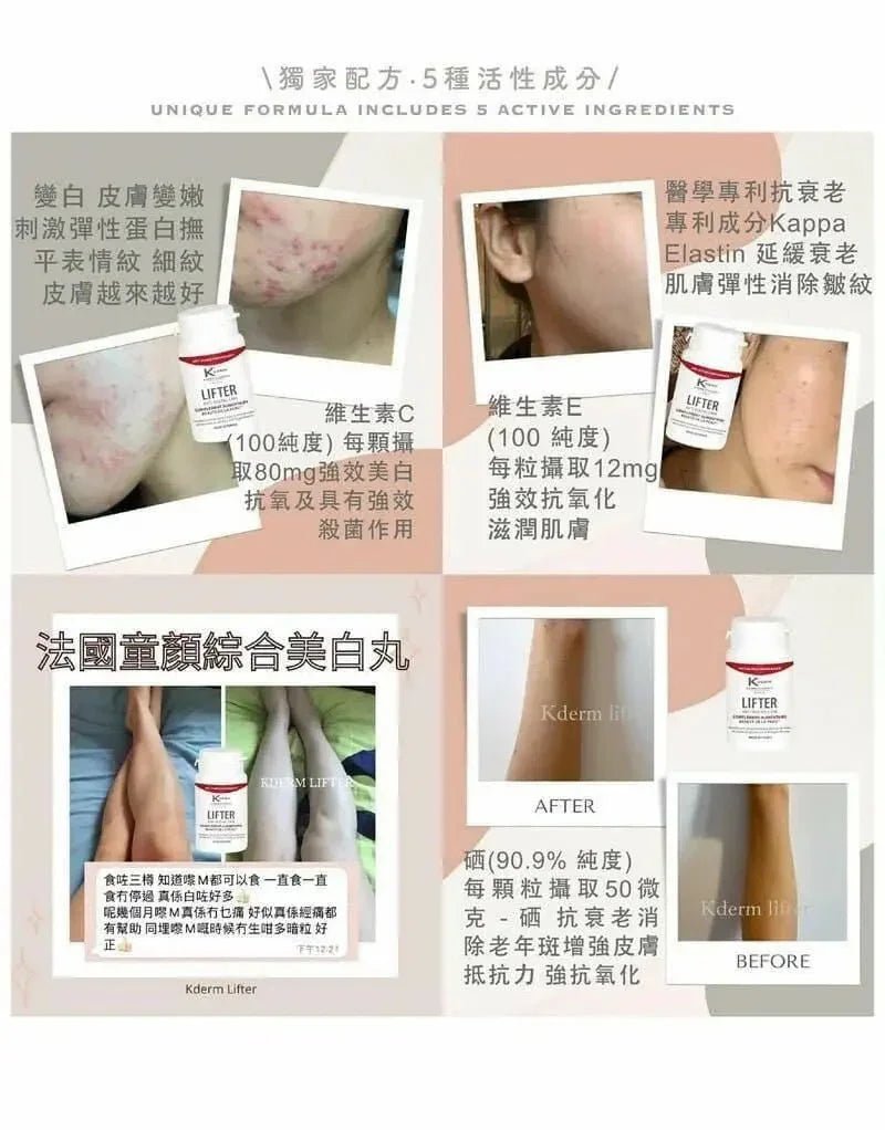 📣限時優惠📣 法國🇫🇷直運 Kderm 美白童顏丸 Lifter Anti - Ageing Care (一盒30粒) - HLY &amp; CHOCCICO