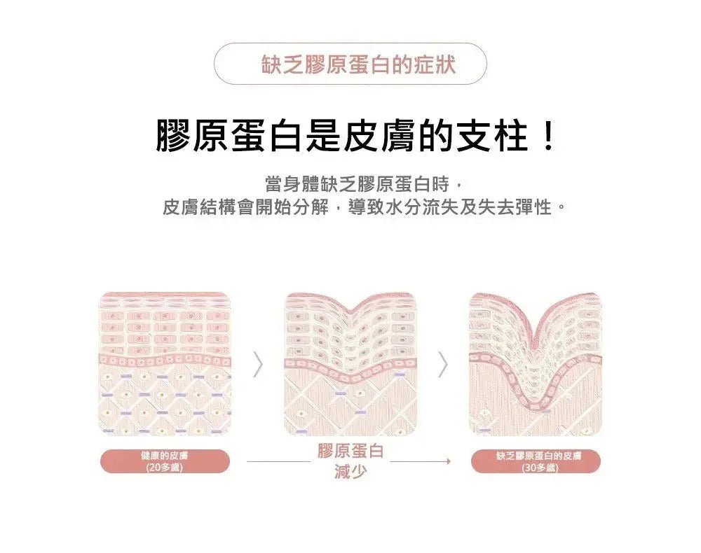 韓國直送M - Pack 首創1秒奇蹟膠原蛋白面膜 + 撫平皺紋填充精華 - HLY &amp; CHOCCICO