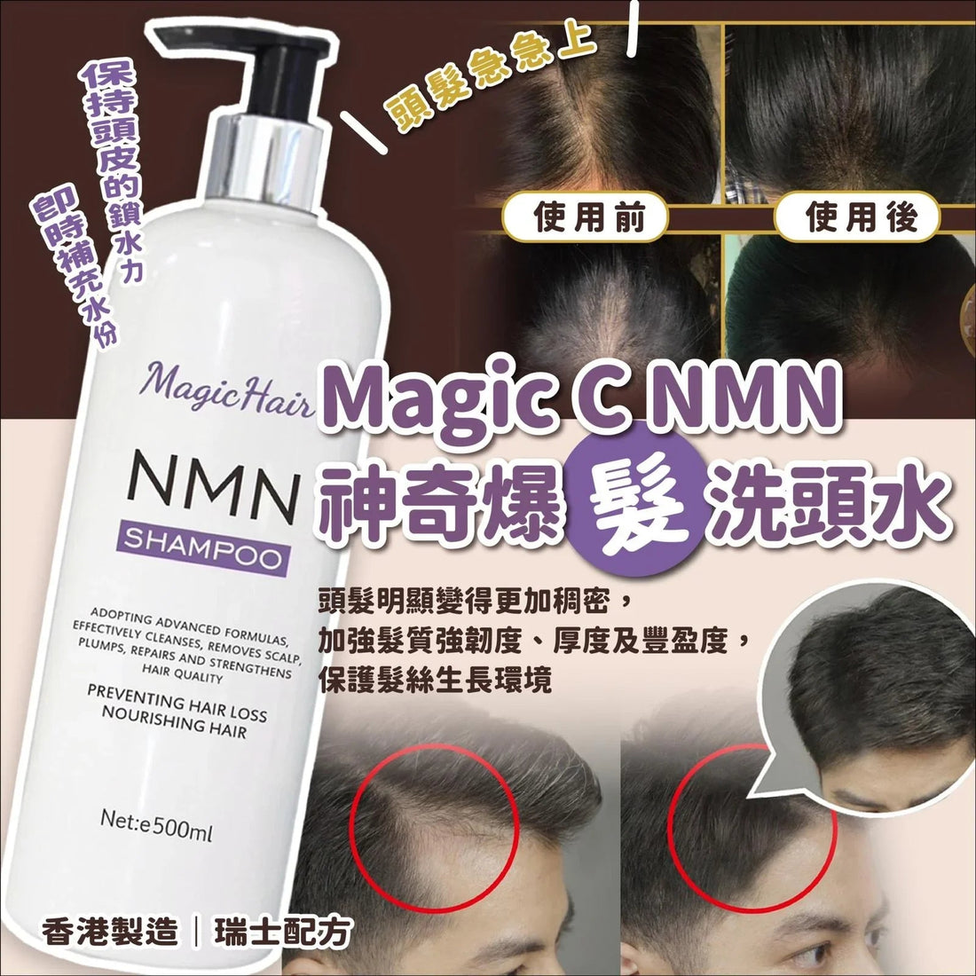 Magic C NMN 神奇爆「髮」洗頭水 - HLY &amp; CHOCCICO