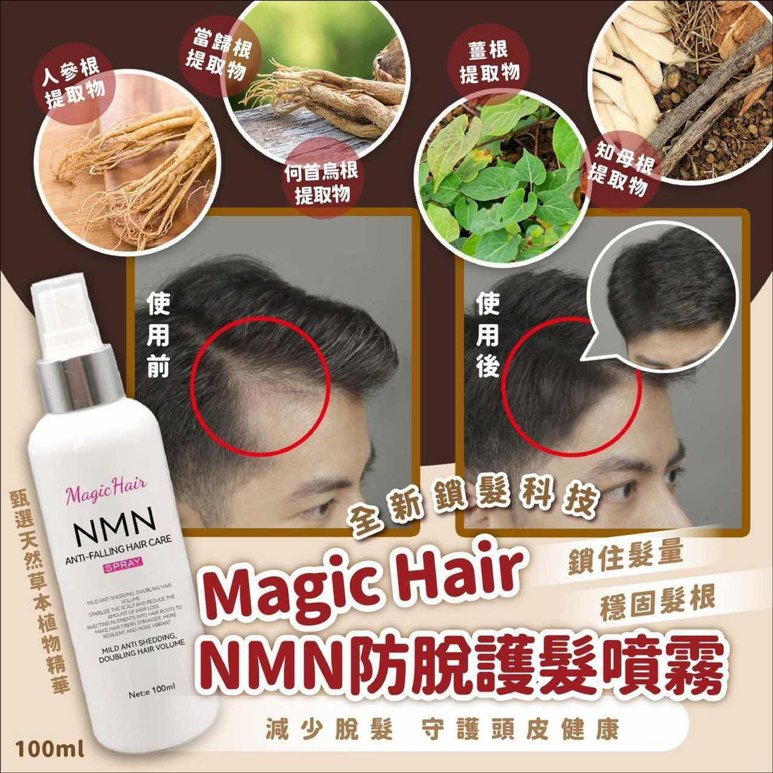 💧Magic Hair NMN防脫護髮噴霧 100ml （此產品不適用折扣） - HLY &amp; CHOCCICO