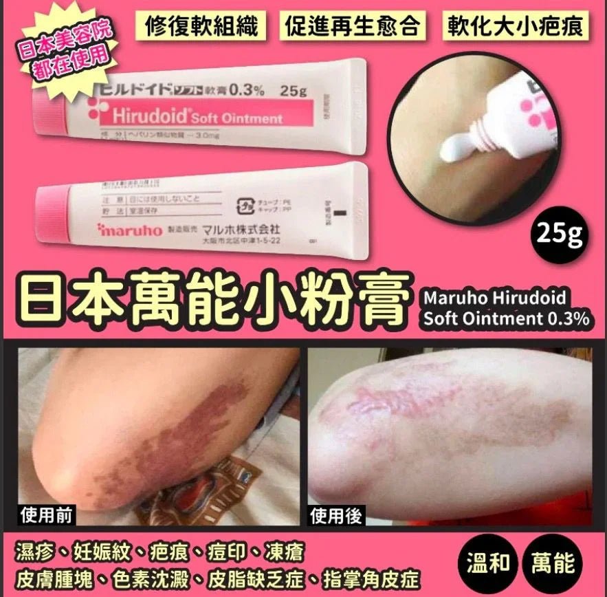💊日本🇯🇵Maruho Hirudoid Soft Ointment 0.3% 萬能小粉膏 25g - HLY &amp; CHOCCICO