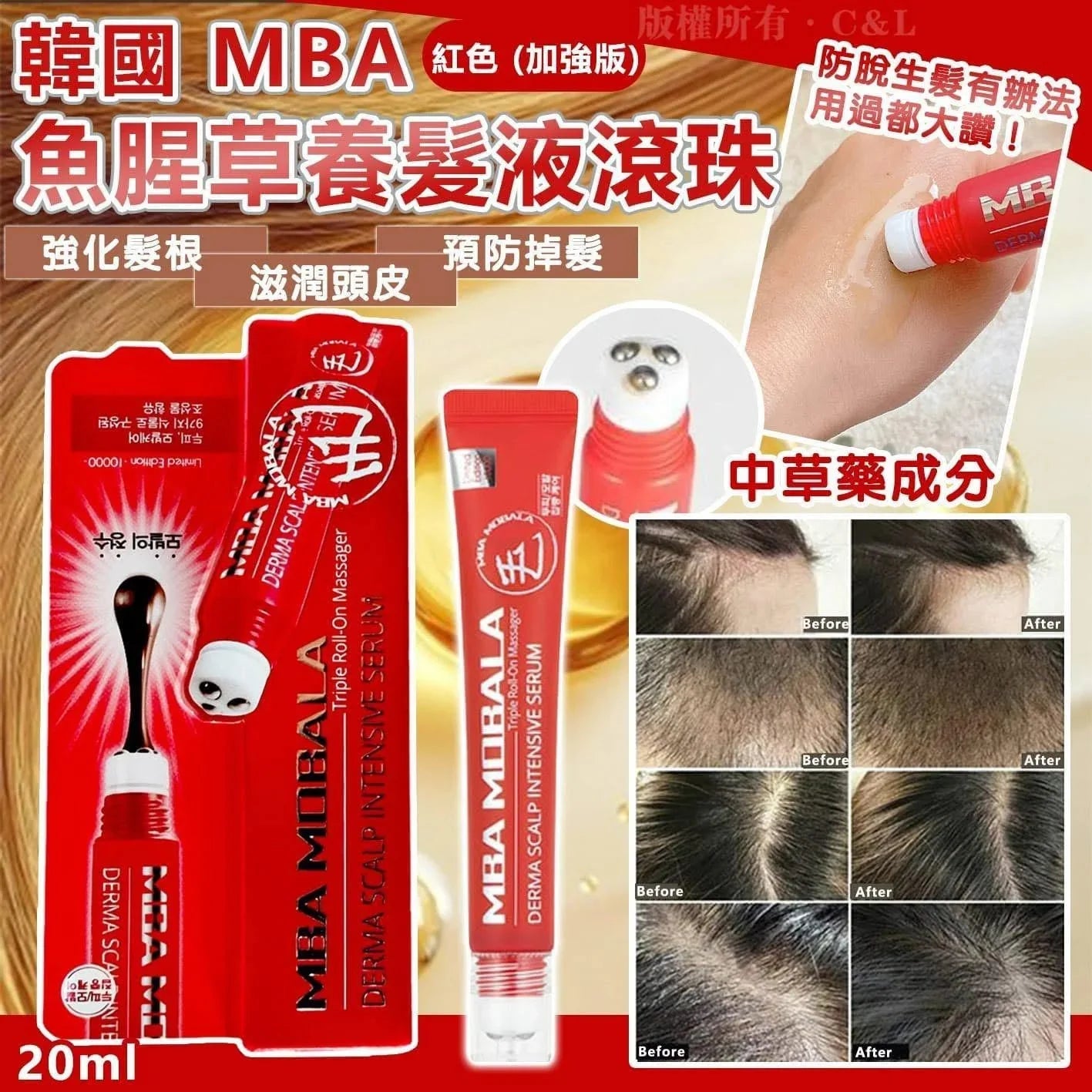韓國 MBA 魚腥草生髮滾珠紅色限量款（20ml）（此產品不適用折扣） - HLY &amp; CHOCCICO
