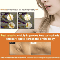 Meditherapy A醛煥膚修護精華 150ml|Meditherapy Retinal Skin Booster Serum 150ml - HLY & CHOCCICO