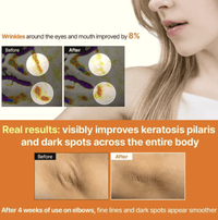 Meditherapy A醛煥膚修護精華 150ml|Meditherapy Retinal Skin Booster Serum 150ml - HLY & CHOCCICO