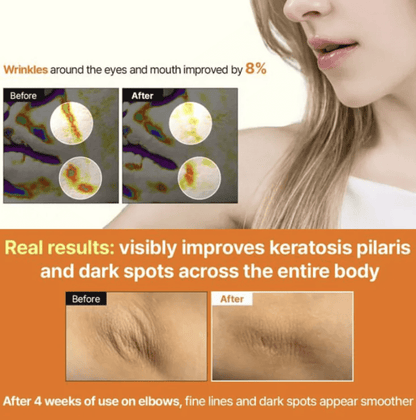 Meditherapy A醛煥膚修護精華 150ml|Meditherapy Retinal Skin Booster Serum 150ml - HLY & CHOCCICO