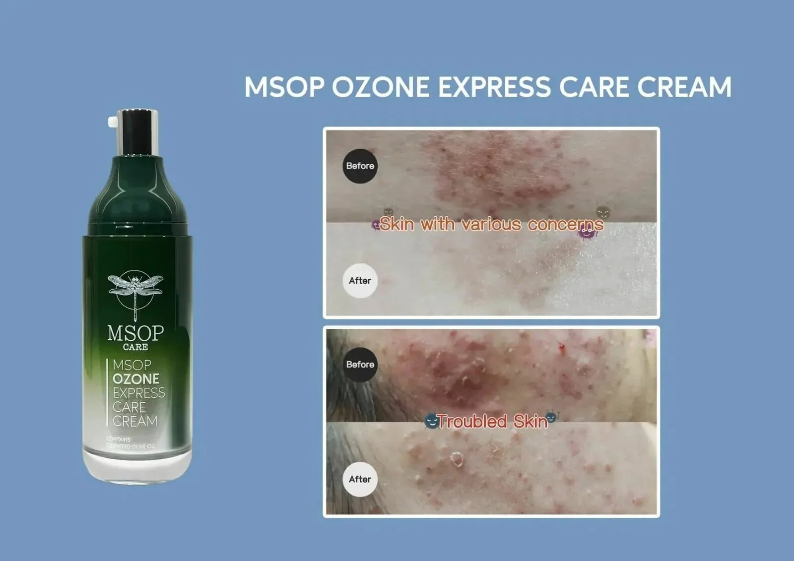 MSOP濕疹修復皇 ✨買一送一 - HLY &amp; CHOCCICO