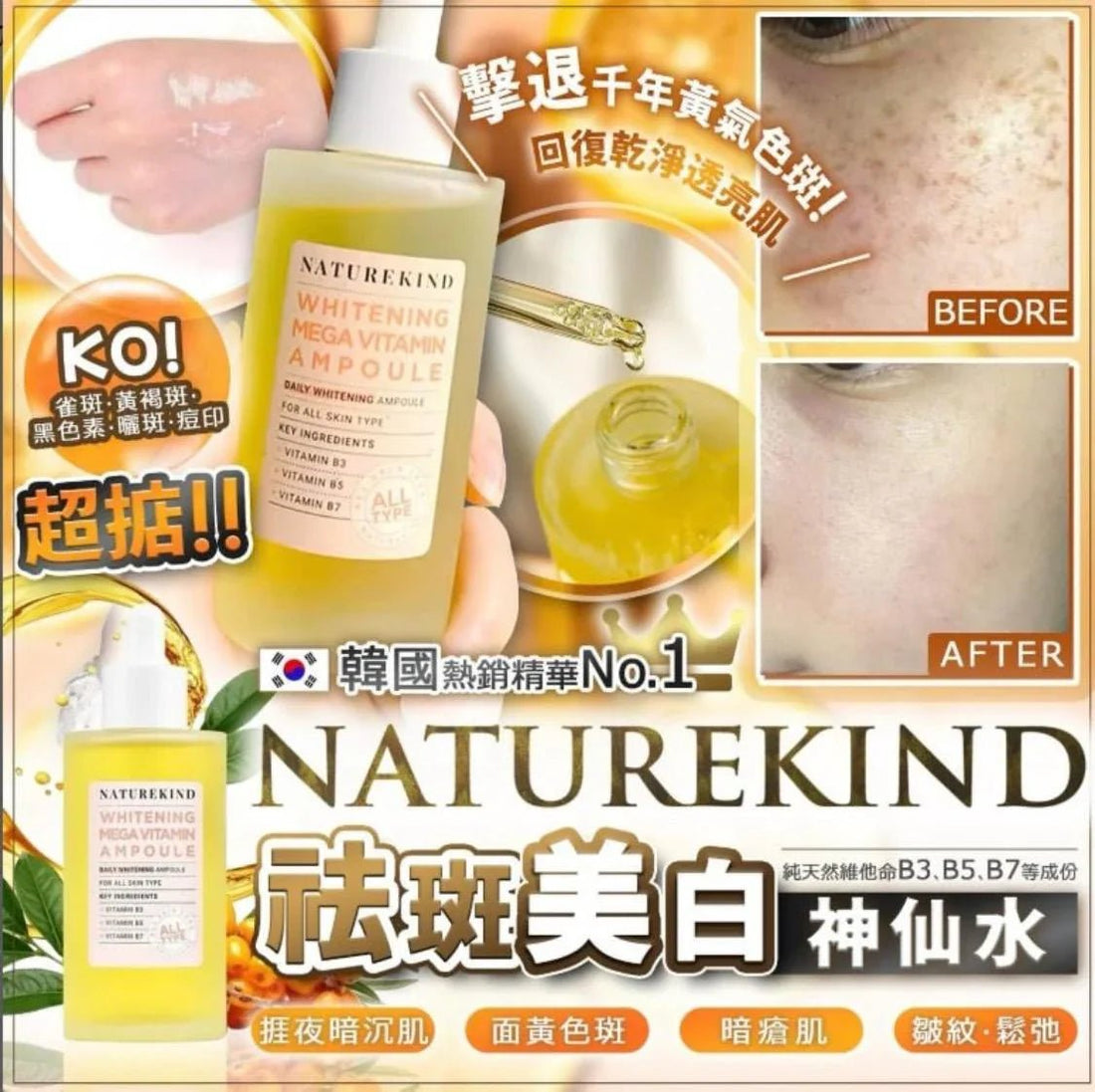 韓國NatureKind祛斑神仙水100ml - HLY &amp; CHOCCICO