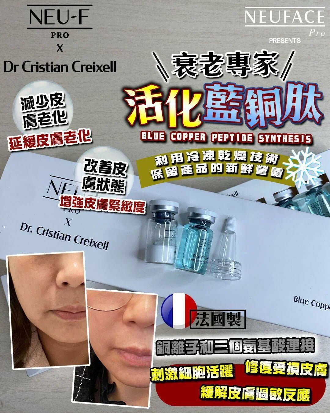NEU - F Pro活化藍銅鈦（4粉4液） - HLY &amp; CHOCCICO